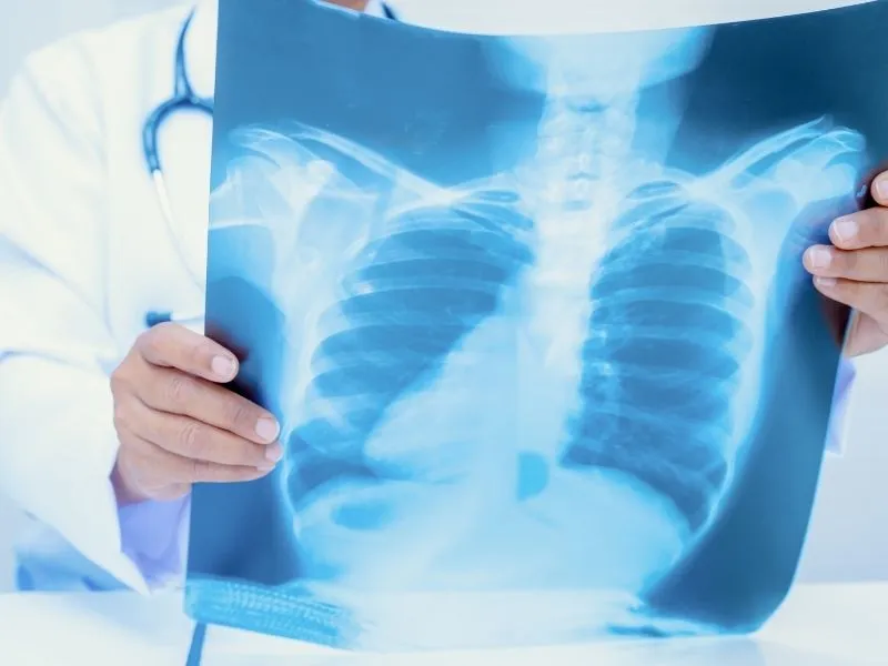 Hipertensão Pulmonar: sintomas, diagnóstico e tratamento