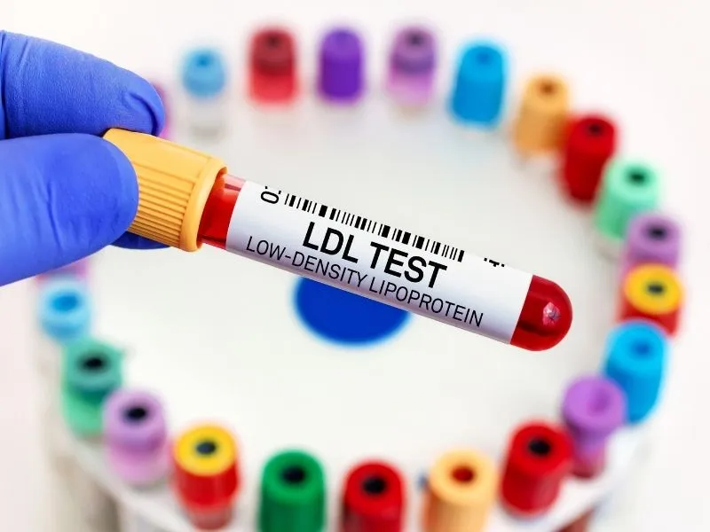 Colesterol LDL Alto: O Que É, Riscos, Metas e Tratamento Segundo as Diretrizes