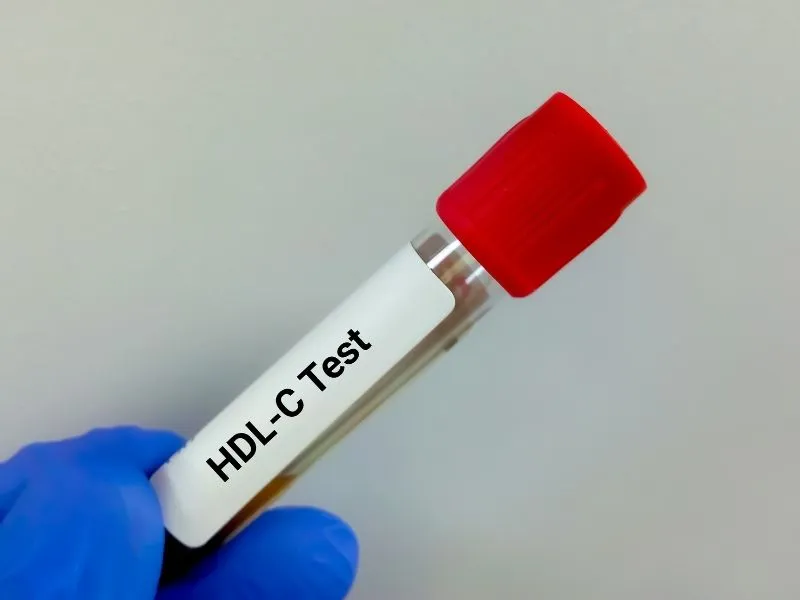 Colesterol HDL: ele baixo eleva o risco de infarto e AVC 