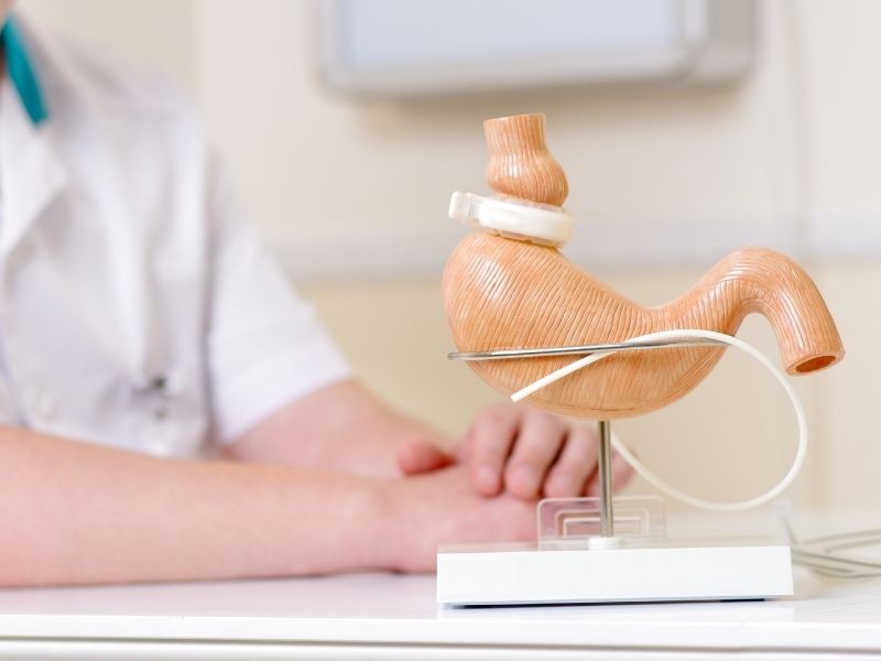 Reposição de Vitaminas e Minerais em Bariátricos: Quais os Nutrientes Essenciais para Suplementação Pós-Cirurgia?